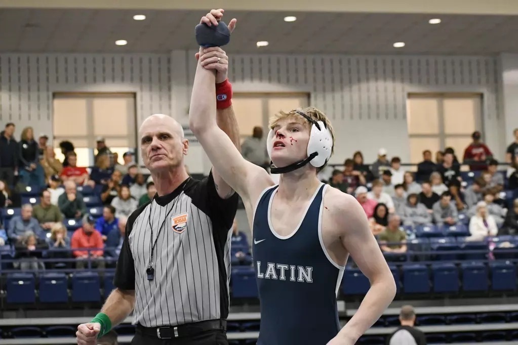 Davis Jones State Chammpionship - protect3d brac - 3d printed custom brace