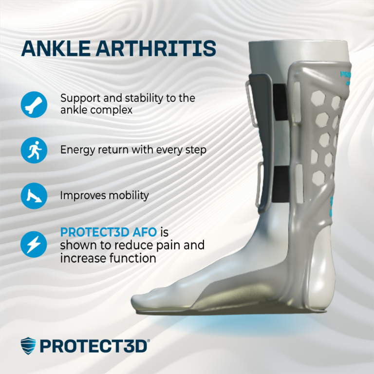 AFO for Ankle arthritis
